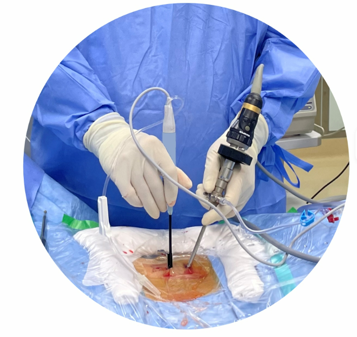 4mm 30° Dual-Port Rigid Endoscope for Spinal Surgery